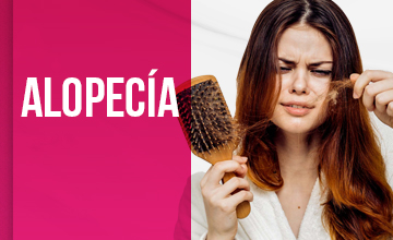 Alopecia